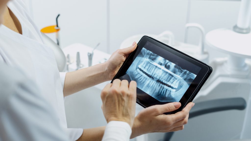 Dentist showing x ray picture to her patient