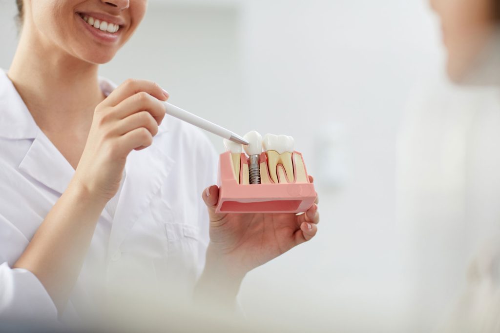 Dentist-Explaining-Tooth-Implantation